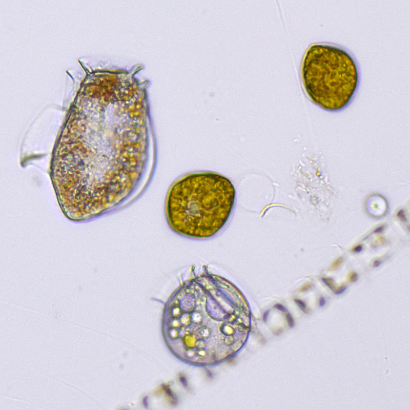 Phytoplankton from the study near a mussel farm on the Swedish Skagerrak coast in autumn 2016. The organism at the top left is Dinophysis acuta, a producer of Diarrhetic Shellfish Toxins. Photo: Bengt Karlson
